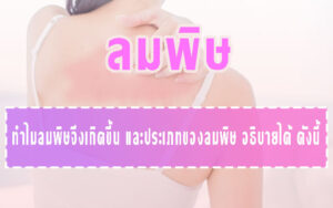 ลมพิษ