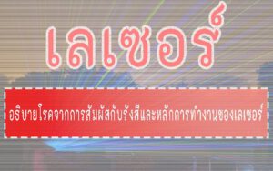 เลเซอร์