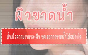 ผิวขาดน้ำ